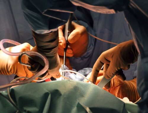 The Pilonidal Survival Guide: Real Talk on Recovery